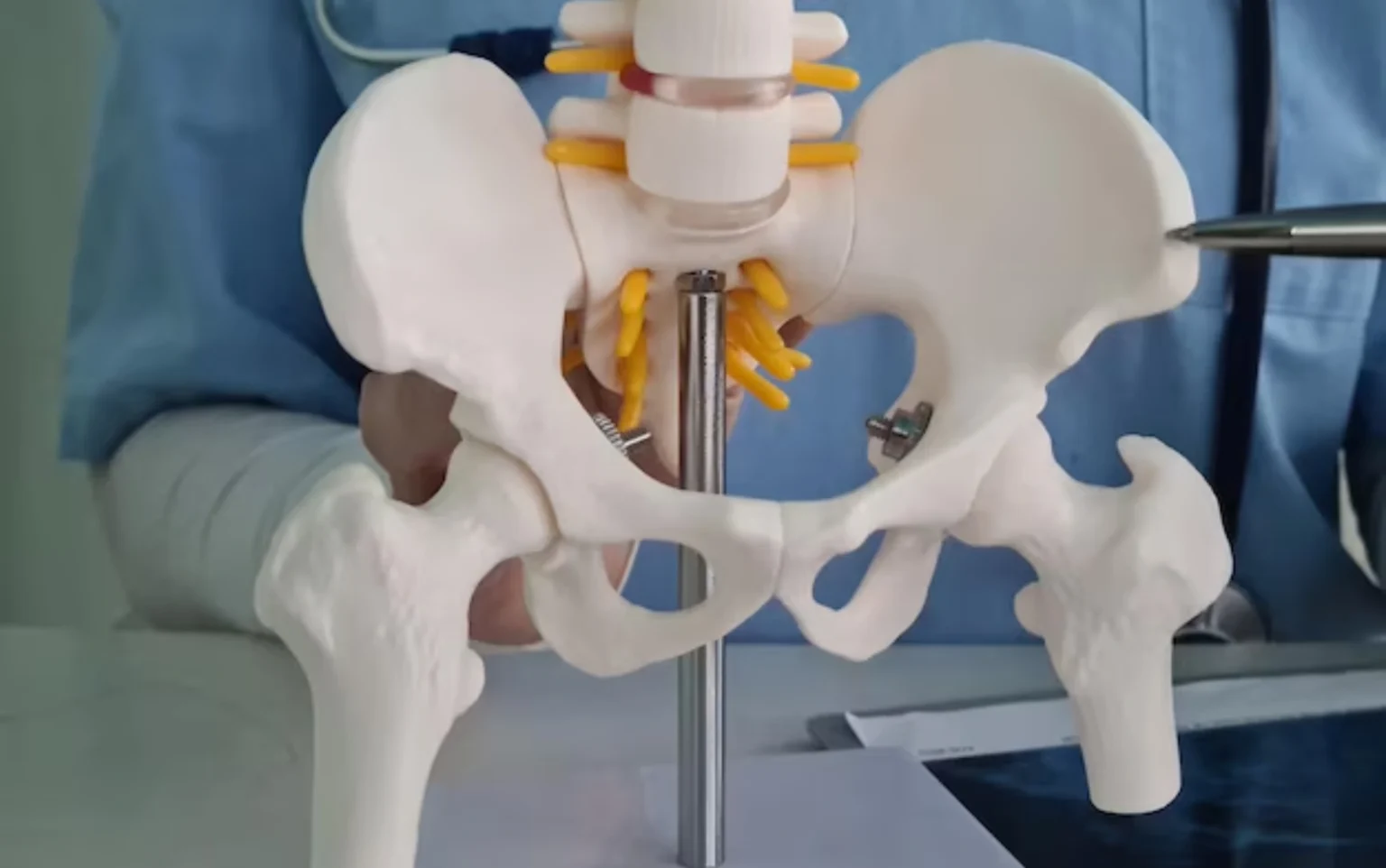 AVN (Avascular Necrosis) Hip Treatment
