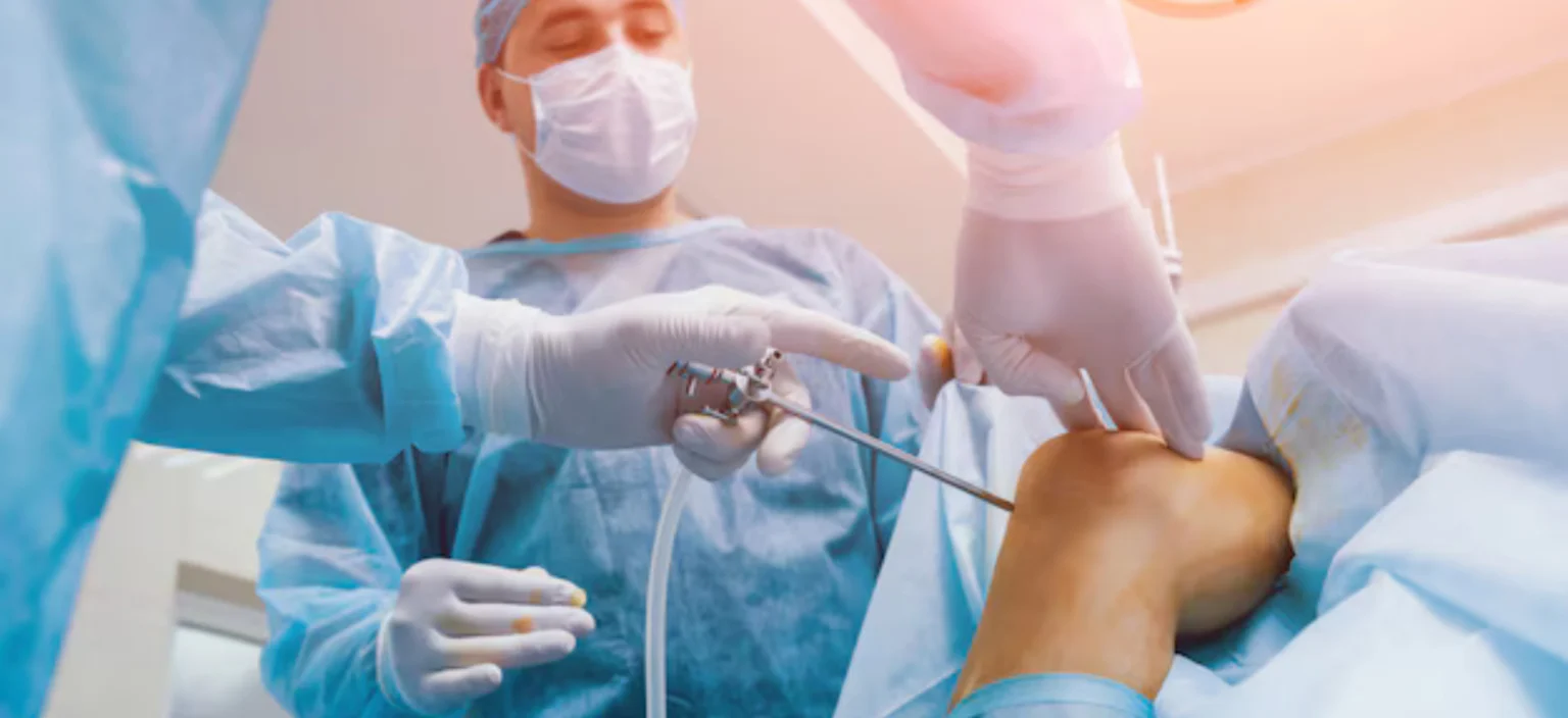 Knee Surgery